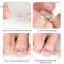 2 Miếng dán chỉnh sửa móng tay Đàn hồi mọc ngược Móng chân Corrector Miếng dán phụ trợ vô hình Paronychia Điều trị phục hồi Corrector Dụng cụ làm móng chân