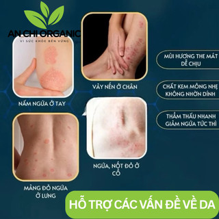 Kem Bôi Nấm Ngứa Viêm Da Cơ Địa NHẬT BẢN XANH LÁ*** Hắc Lào, Tổ Đỉa, Vẩy Nến, Á Sừng, Lang Ben An Chi Organic