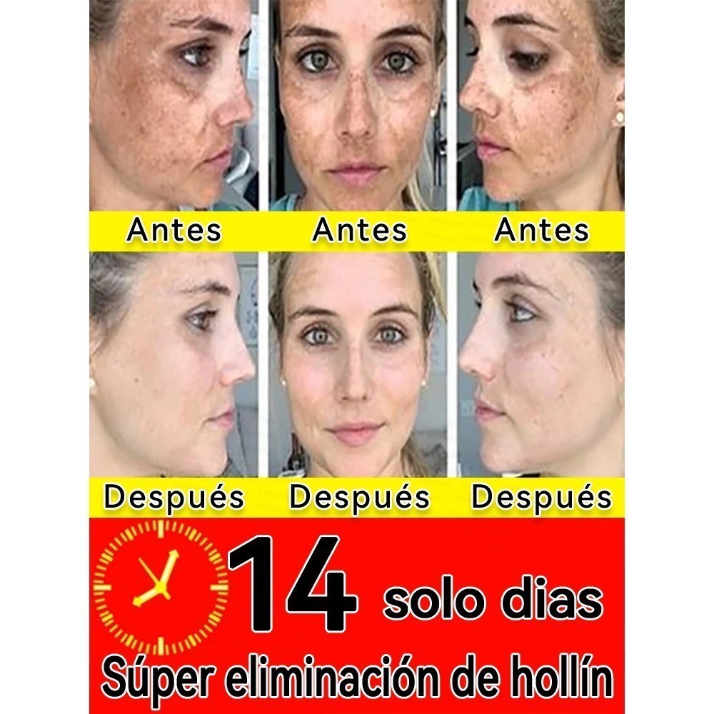 Bút Laser chăm sóc điểm di động Làm sáng da không xâm lấn cho người lớn Sử dụng tại nhà & du lịch để cải thiện điểm