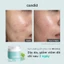 Kem dưỡng ẩm phục hồi Candid B5 Cica Repair & Smoothing Cream | Phục hồi, làm dịu, thấm nhanh