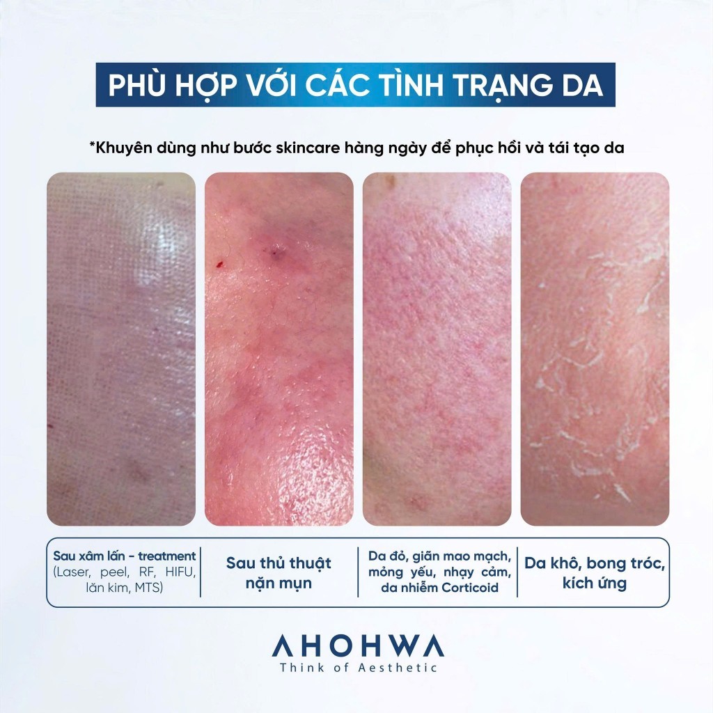 Mặt Nạ AHOHWA Vitamin K Calming Mask Cấp Ẩm Phục Hồi