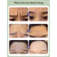 Sản phẩm xóa nếp nhăn vùng trán mắt miệng hiệu quả Miếng dán chống nhăn،Miếng dán ngủ، Dán vùng Trán