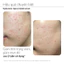 Serum kẽm Ekseption Hyaluronic ZnPCA, HA + 1% ZnPCA giảm mụn, kiềm dầu 75ml
