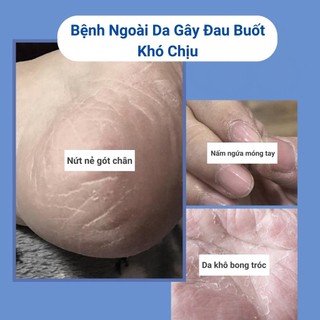 Kem Dưỡng Gót Chân Chống Nứt Nẻ, Kem Dưỡng Ẩm Chống Nứt Nẻ Ngăn Ngừa Và Phục Hồi Vết Nứt Chai Sần