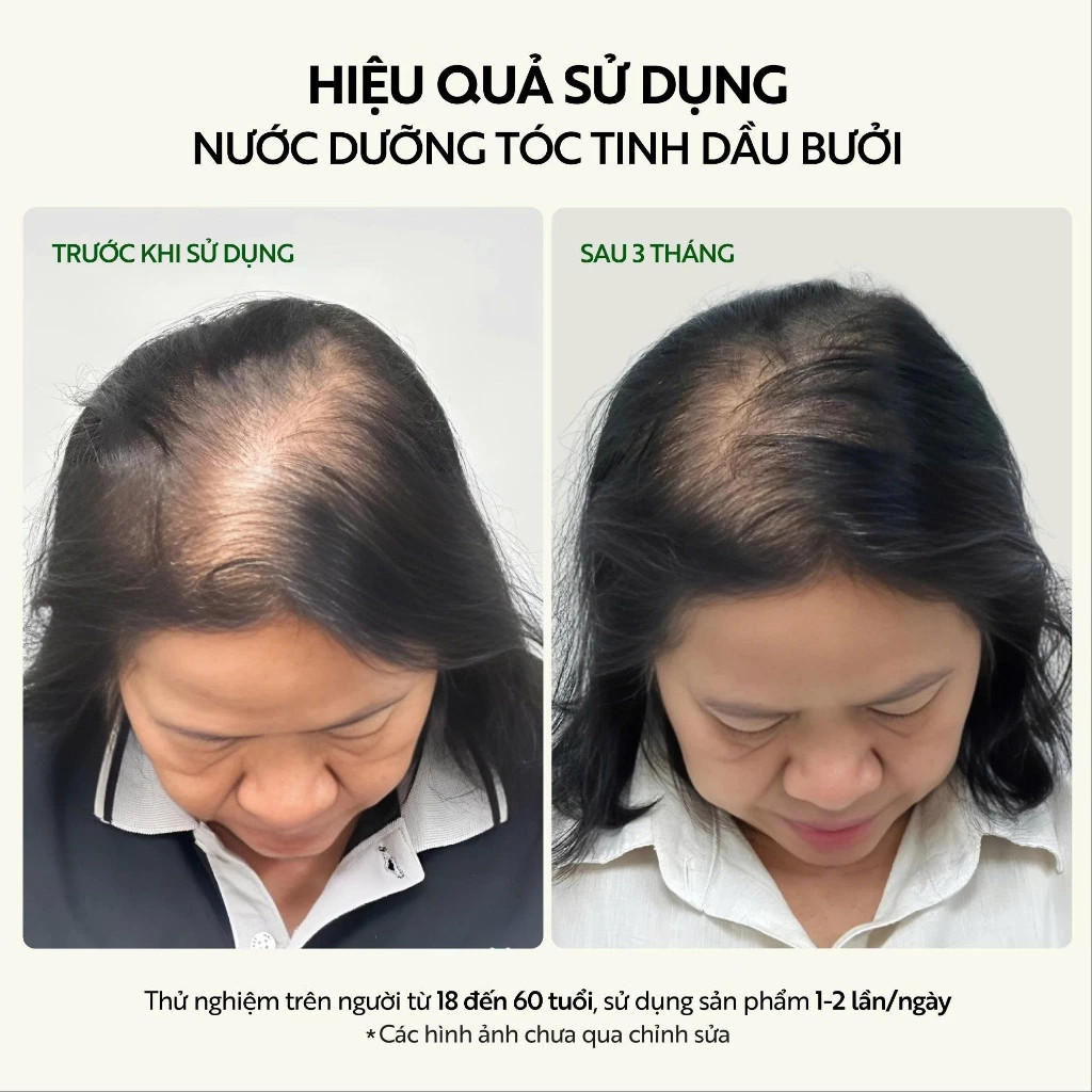 Cocoon Tinh Dầu Dưỡng Tóc Bưởi – Nuôi Dưỡng Tóc Chắc Khỏe, Mềm Mượt