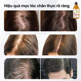 Dầu Gội chống rụng  tóc Gừng Kích Thích Mọc Tóc Giảm Rụng Tóc Làm Sạch Sâu Da Đầu Nhanh kiểm soát dầu loại bỏ gàu500ml