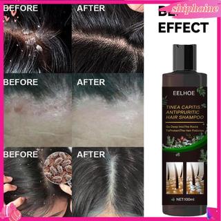 100Ml dầu gội tóc Bọt Giàu kiểm soát dầu Chăm Sóc Tóc Chống-Gàu Chống-Ngứa Dầu Gội Đầu Cho Nam Nữ