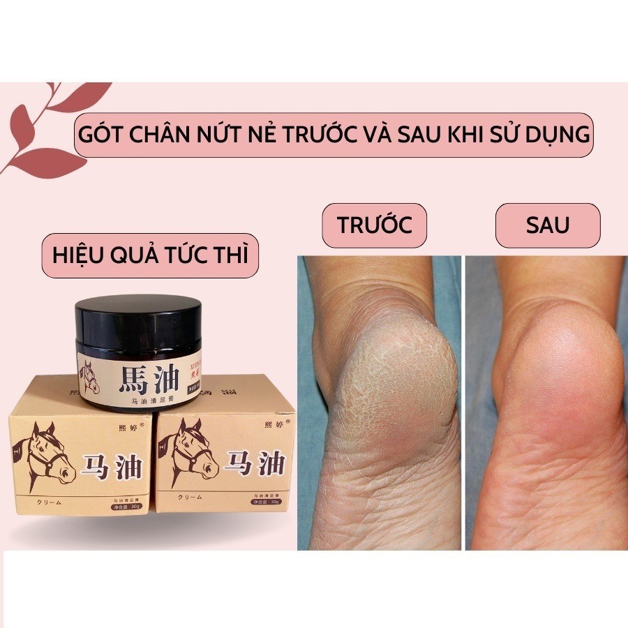 BOMBO 3 HỘP Kem Nẻ Ngựa Nội Địa Trung 50gram Kem Dưỡng Ẩm Chống Nứt Nẻ Vùng Da Dưỡng Gót Hồng - Tay Mịn - Môi Căng Mọng