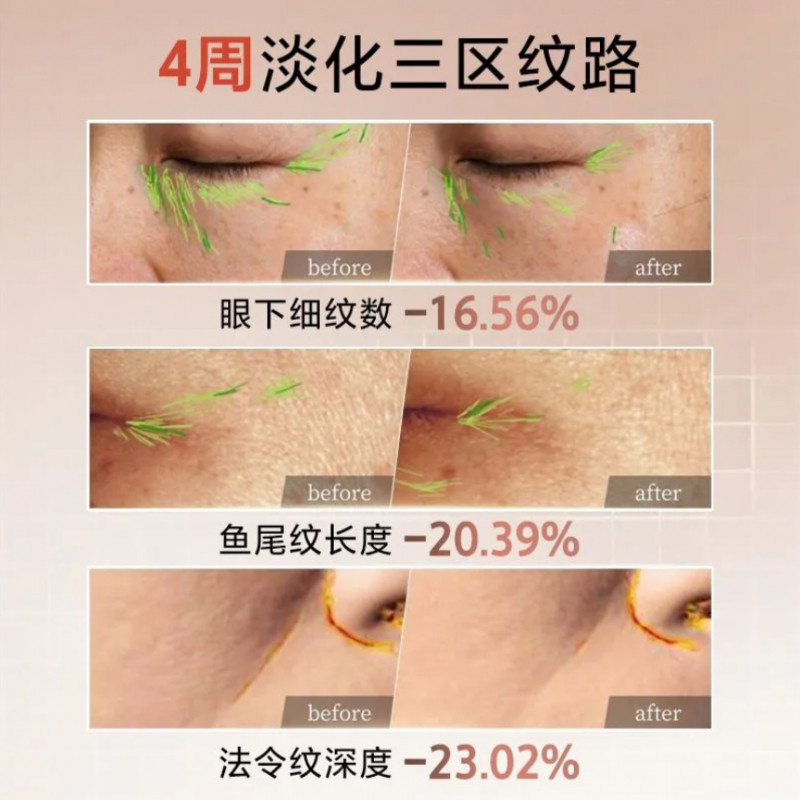 Mặt nạ DA LANE siết chặt và nâng mặt chữ V, phai nếp nhăn, thức khuya để sơ cứu RGJX