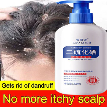 Selenium sulfide Dầu gội giảm nấm ngứa da đầu , dầu gội dược liệu nấm da đầu, giảm ngứa, giúp tóc chắc khoẻ,sạch gàu