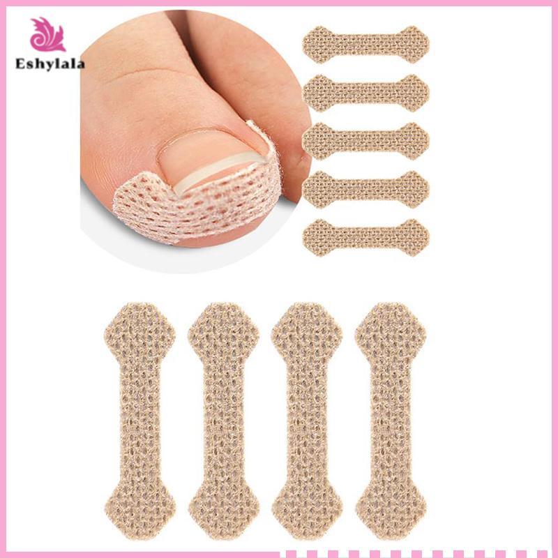 Eshylala 4 / 10 Tờ Dụng cụ làm móng chân mọc ngược Móng chân Stiers cho dụng cụ chỉnh sửa móng tay Paronychia Treatment Fixer Recover Bunion Feet Care [MỚI]