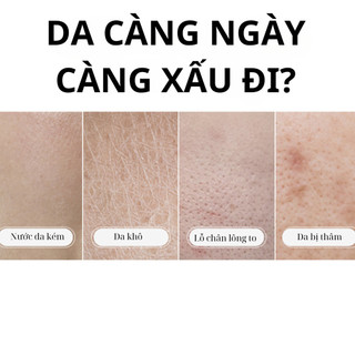 Serum Kem dưỡng ẩm, làm se khít lỗ chân lông, giữ ẩm, chăm sóc da săn chắc đem lại làn da mịn màng, sáng bóng