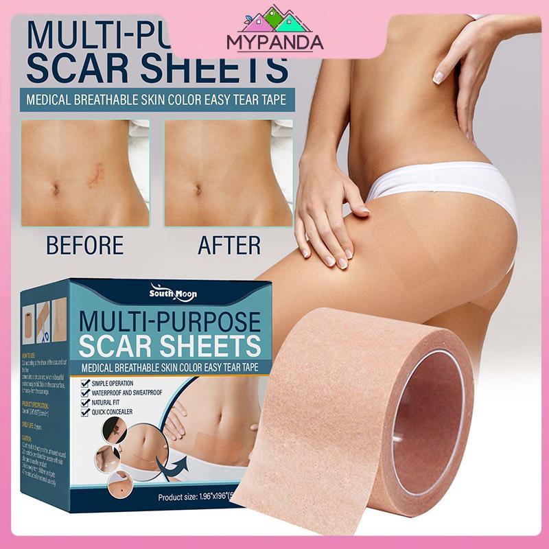 MYPANDA 1 Cuộn Màu Da Che Khuyết Điểm Hình Xăm Stiers Che Khuyết Điểm Hình Xăm Burn Scar Birthmark Miếng Dán Vô Hình Băng Chống Thấm Nước.