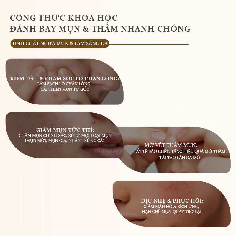 WithUpure Ngăn Ngừa & Hỗ Trợ Giảm Mụn Serum 10ml + 30 Que Tăm Bông, Bộ Sản Phẩm Chăm Sóc Da