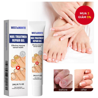 Kem phục hồi móng Móng kháng khuẩn chân loại nấm móng gãy móng chống Kem giúp hết nấm làm thối móng tay móng chân Tinh c