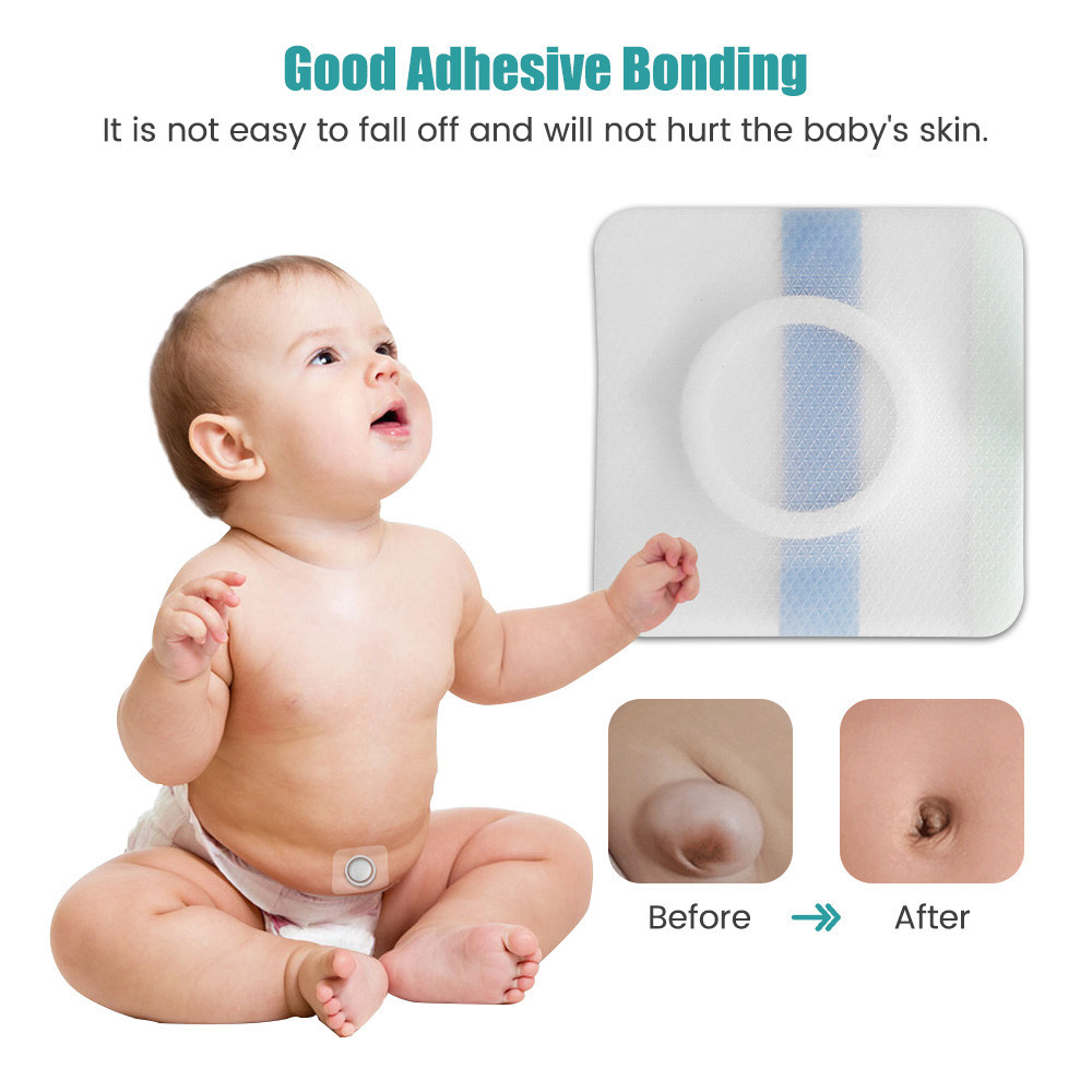 Miếng dán thoát vị cho bé thoáng khí bảo vệ da Chống thấm nước،Thân thiện với da،Bảo vệ rốn khi tắm