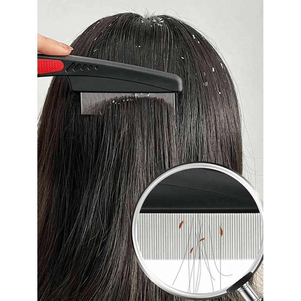 【COD】Lược bắt chấy răng siêu mịn, thiết kế an toàn không làm tổn thương da đầu, dễ dàng loại bỏ chấy và trứng chấy triệt