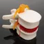 Mô hình thắt lưng CODECOVED, Mô hình 3D 1.5X Phóng to Mô hình bộ xương giải phẫu con người, Mô phỏng Công cụ giáo dục nén Trình diễn Công cụ giảng dạy thoát vị đĩa thắt lưng