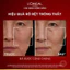 Dưỡng chất ba loại peptides giảm nhăn, săn chắc da L'Oréal Paris Revitalift Triple Power 6ml