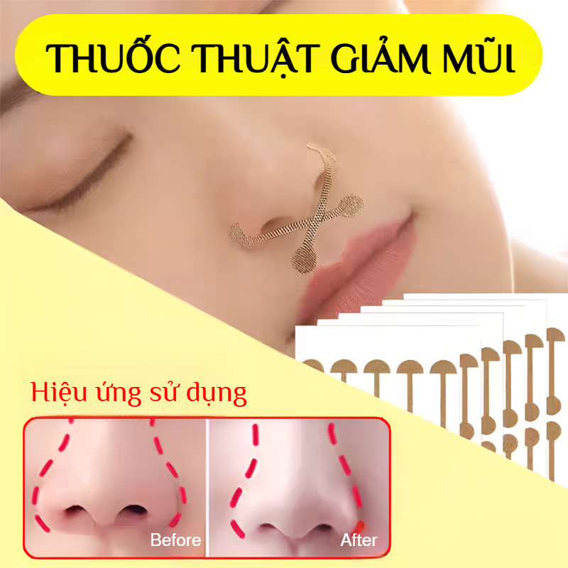 Miếng dán thu nhỏ cánh mũi 15 ngày / Miếng dán làm đẹp và thu nhỏ cánh mũi / Miếng dán tạo hình mũi / Miếng dán làm đẹp cánh mũi tiện lợi