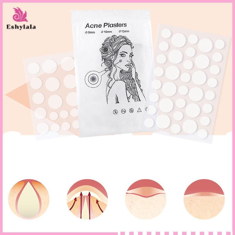 Eshylala 24 / 36 Miếng Dán Miếng Dán Mụn Hydrocolloid Miếng Dán Hình Dạng Chống Thấm Nước Màu Trắng Tròn Điểm Điều Trị Mụn Miếng Dán Che Khuyết Điểm [MỚI]