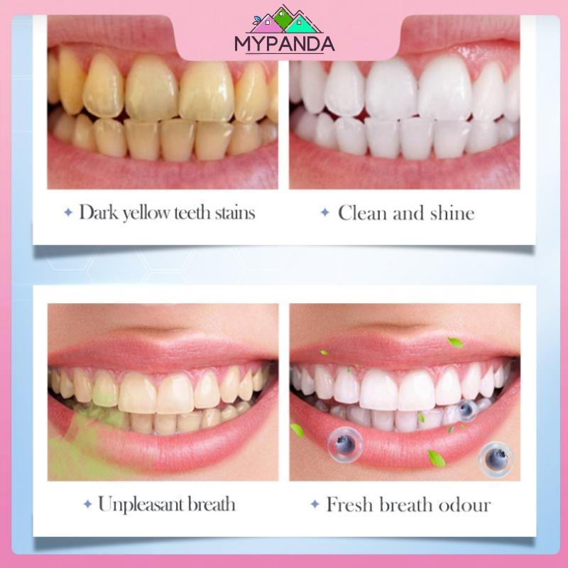 MYPANDA 30 Viên / Chai Kem Đánh Răng Viên Cải Thiện Hơi Thở Xấu Loại Bỏ Vết Bẩn Vệ Sinh Răng Miệng Tươi Viên Kem Đánh Răng Chắc Chắn.