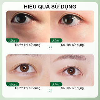 Kem Dưỡng Da Mắt Centella asiatica 20g Làm Trắng Dưỡng Ẩm Chống Nếp Nhăn Lão Hóa Xóa Mờ Bọng Mắt Quầng Thâm