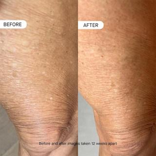 OneSkin BODY OS-01 Peptide Topical Supplement & Skin Longevity Age Reversal