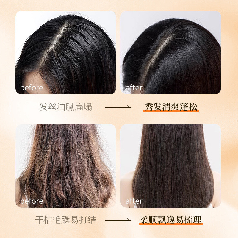 Bác sĩ Dumei Nhân Sâm Chiết Xuất Thực Vật Gội Mềm Nuôi Dưỡng Bên Lá Cypress Thảo Dược Kiểm Soát Dầu Lông Tơ 2.26