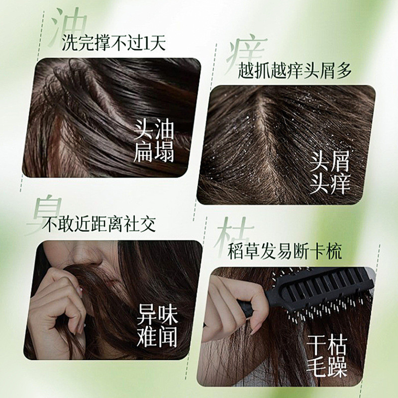 Auonam Auonam Cypress Lá Dầu Gội Xà Phòng Thảo Dược Thực Vật Chiết Xuất Tinh Chất Tự Nhiên Dầu Gội Xà Phòng Giảm Ngứa Lông Tơ 3.20