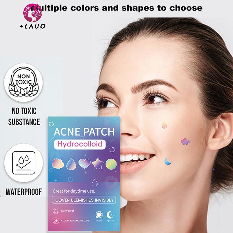 Springevenstar 180 / 360 Cái Acne Pimple Patch Stier Chống Thấm Nước Điều Hỗ trợ giảm mụn Mụn Công Cụ Tẩy Mụn Mặt nạ SkinCare Hidden Pimple Springevenstar