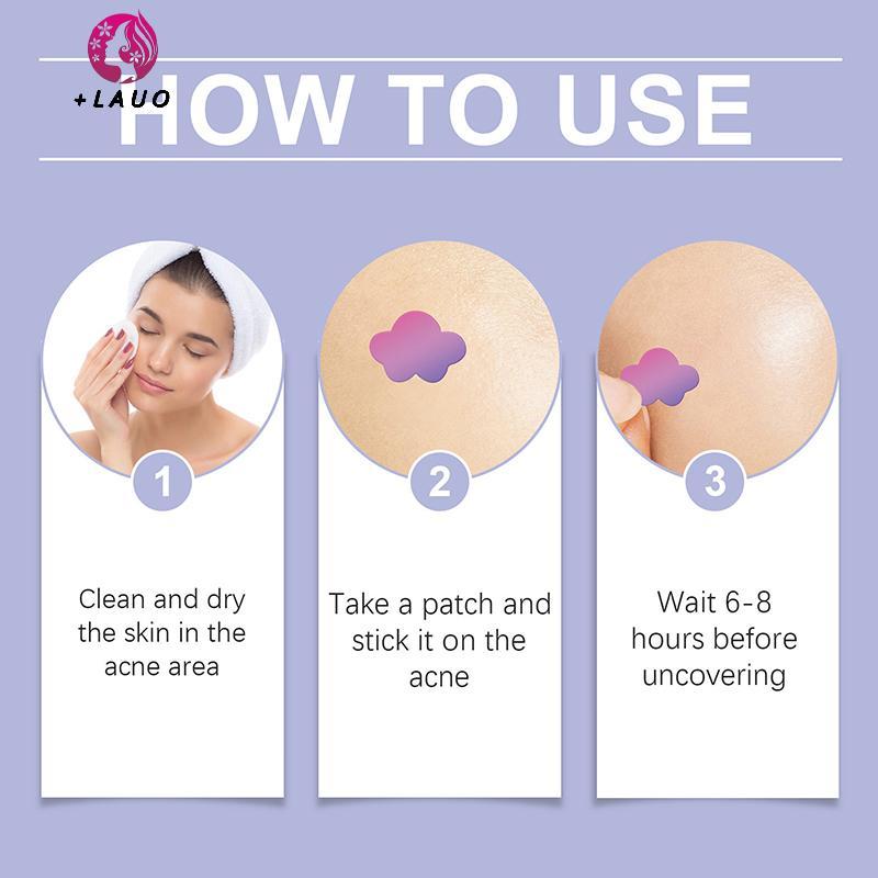 Springevenstar 180 / 360 Cái Acne Pimple Patch Stier Chống Thấm Nước Điều Hỗ trợ giảm mụn Mụn Công Cụ Tẩy Mụn Mặt nạ SkinCare Hidden Pimple Springevenstar