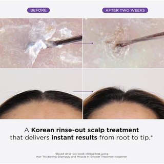 Dr. Groot Miracle in Shower Treatment for Hair Loss - Korean Care 5-Second Smooth