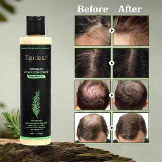 Tgideas Organic Rosemary Hair Growth Shampoo, Suitable for Both Men Women-Containing Hydrolyzed Keratin Natural Thickening Intensive