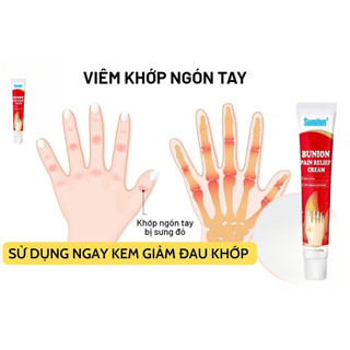 combo 2 Kem Bôi Giúp Giảm Đau Nhức Các Khớp Ngón Chân, Ngón Tay, Giúp Nhanh Chóng Giảm Viêm Xương Khớp Trên Cơ Thể