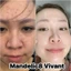 Serum Vivant Skincare 8% Mandelic Acid 3-in-1 30ml | Giảm mụn, căng bóng, chống lão hoá
