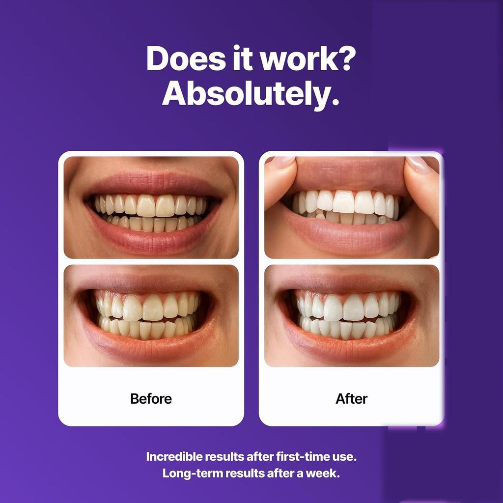 Dải Làm Sáng Nhạy Cảm Loại Bỏ Vết Bẩn Làm Sáng Corrector 14 Miếng Hiệu Chỉnh Màu Sắc Tự Nhiên Dải Răng Cho Nhà Hàng Ngày ewoekvn