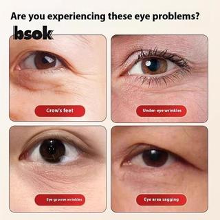 Trailblazer Brass Lotus Eye Massage Sti Facial Gua Sha Tool Dụng cụ cầm tay để thư giãn mắt và massage bấm huyệt kinh tuyến Mới