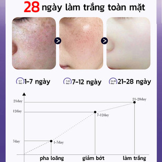 tinh chất cấy trắng da mặt 7 ngày sạch tàn nhang Serum trắng da và xóa tàn nhang 30ml Hiệu quả làm mờ thâm nám tàn nhan