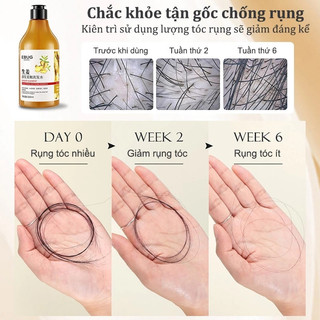 Dầu Gội chống rụng  tóc Gừng Kích Thích Mọc Tóc Giảm Rụng Tóc Làm Sạch Sâu Da Đầu Nhanh kiểm soát dầu loại bỏ gàu500ml