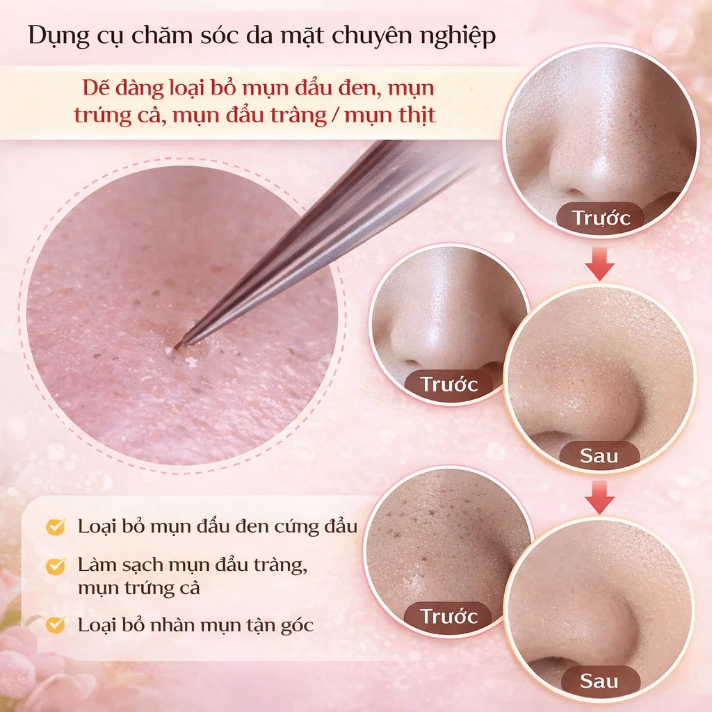 【Thép Không Gỉ/Đầu Nhọn Chính Xác】Bộ Dụng Cụ Nặn Mụn Đầu Đen Thép Không Gỉ X21083106CB Kẹp Mụn Đầu Đen/Nhíp Nặn Mụn/Nhíp Tế Bào/Thép Không Gỉ/Bộ Dụng Cụ Chăm Sóc Da