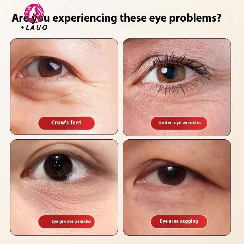 Springevenstar Brass Lotus Eye Massage Sti Facial Gua Sha Tool Dụng cụ cầm tay để thư giãn mắt và massage bấm huyệt kinh tuyến Springevenstar