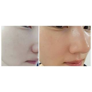 MEDIHEAL Madecassoside Blemish Repair Serum All Skin Types Korean
