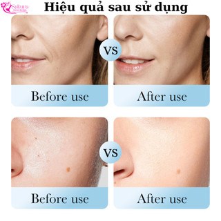 Sữa Rửa Mặt Giúp Sạch Sâu, Tái Tạo Da, Ngừa Mụn, Tạo Hàng Rào Bảo Vệ Da Mịn Màng, Căng Bóng
