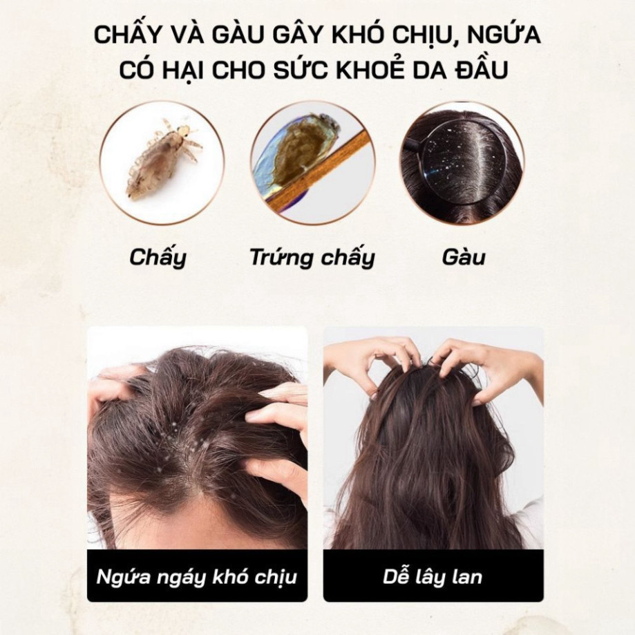 【COD】Lược trúc chải gàu thiết kế truyền thống, nhẹ nhàng loại bỏ vảy gàu và bụi bẩn trên da đầu một cách sạch sẽ.