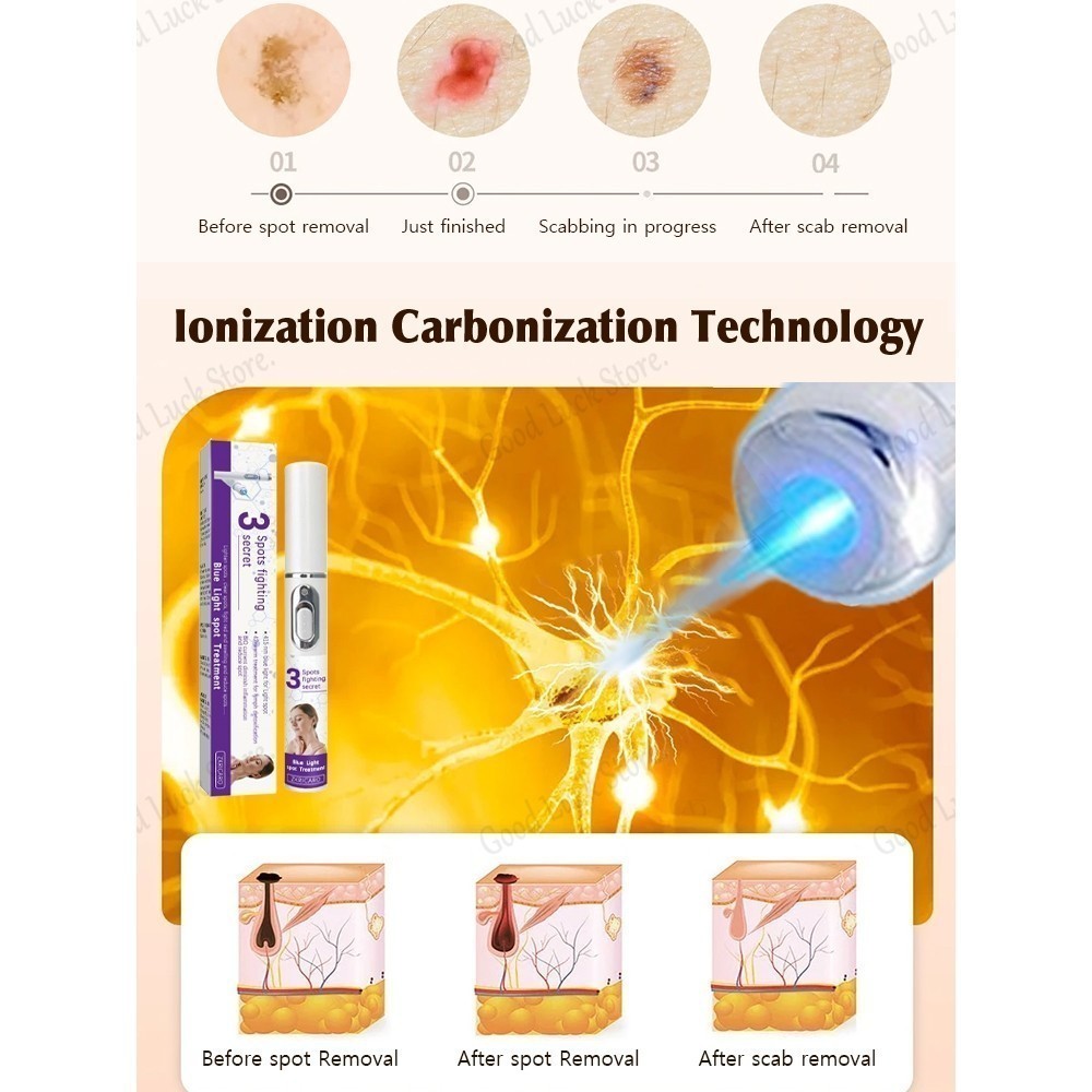Bút Laser chăm sóc điểm di động Làm sáng da không xâm lấn cho người lớn Sử dụng tại nhà & du lịch để cải thiện điểm