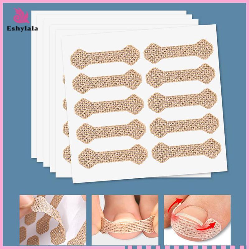 Eshylala 4 / 10 Tờ Dụng cụ làm móng chân mọc ngược Móng chân Stiers cho dụng cụ chỉnh sửa móng tay Paronychia Treatment Fixer Recover Bunion Feet Care [MỚI]