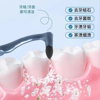 Máy mài răng thủ công mờ, loại bỏ vết bẩn răng260330EE