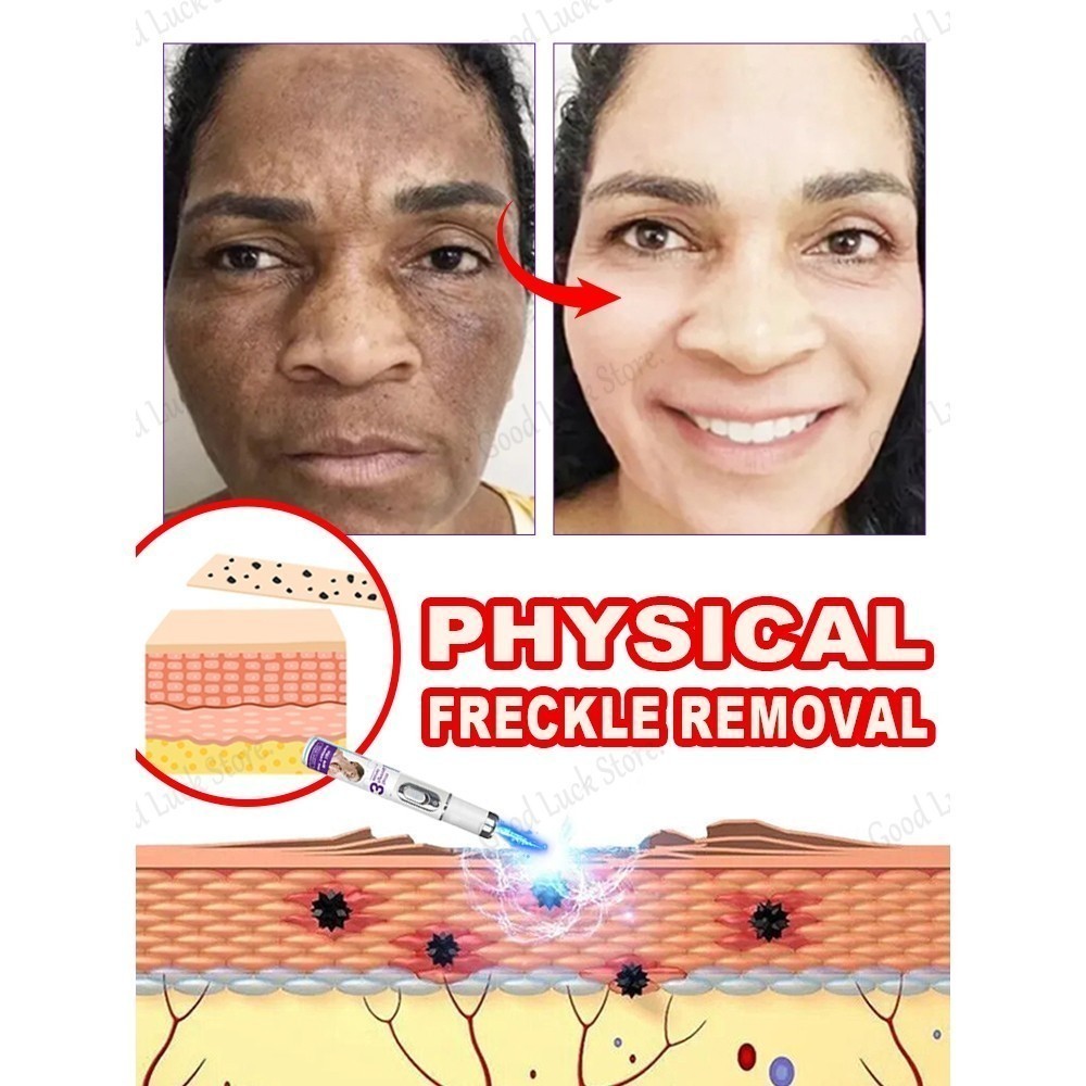 Bút Laser chăm sóc điểm di động Làm sáng da không xâm lấn cho người lớn Sử dụng tại nhà & du lịch để cải thiện điểm