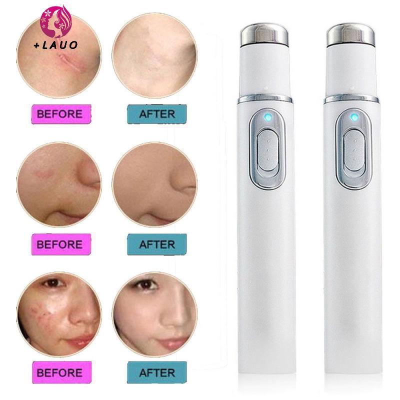 Springevenstar Trị liệu ánh sáng xanh Bút Laser trị liệu ánh sáng mặt LED cho sẹo Thiết bị điều trị loại bỏ nếp nhăn Chăm sóc da Thiết bị làm đẹp Springevenstar
